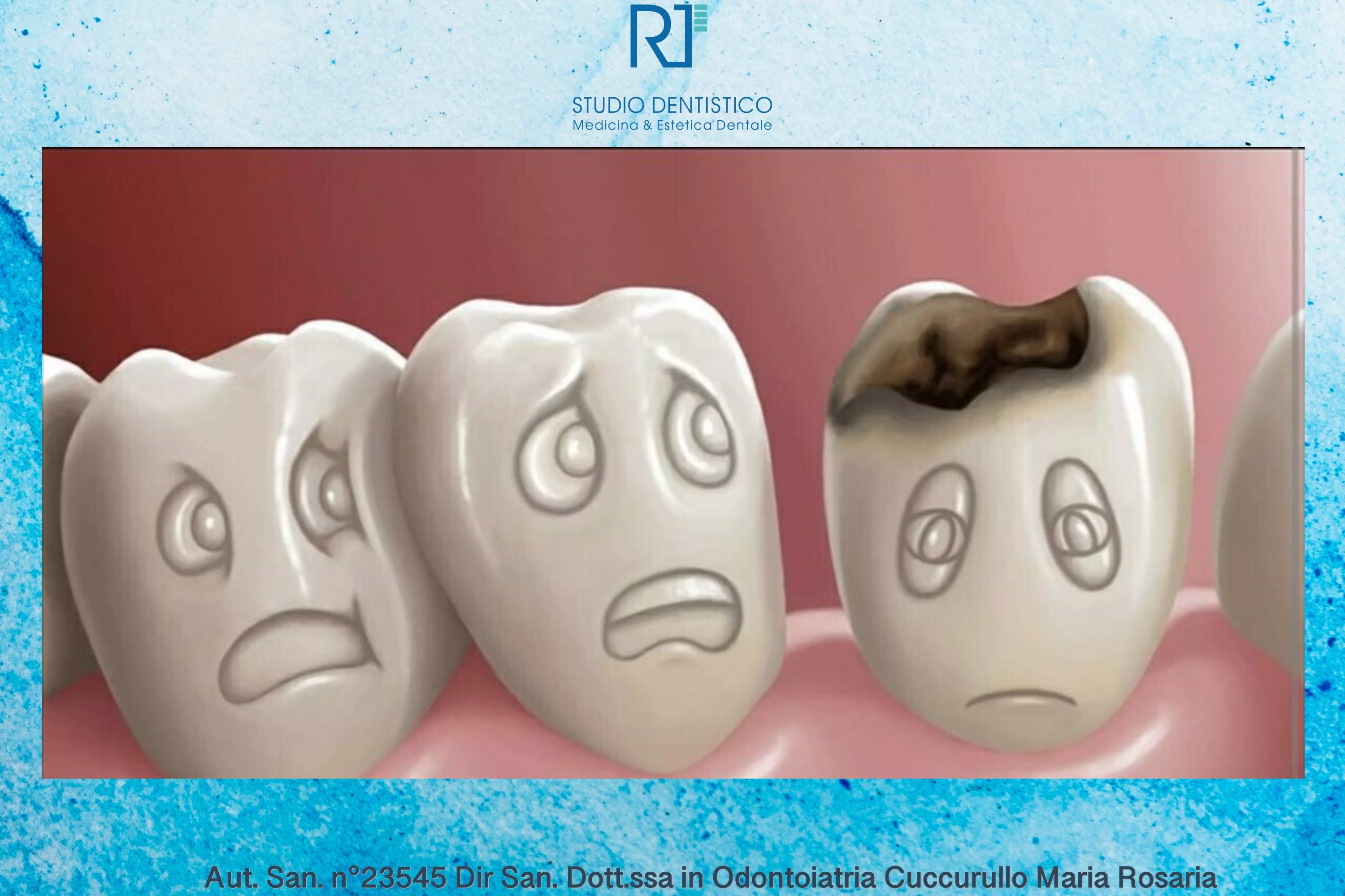 Carie dentale: cos’è, sintomi, cause, diagnosi e cura